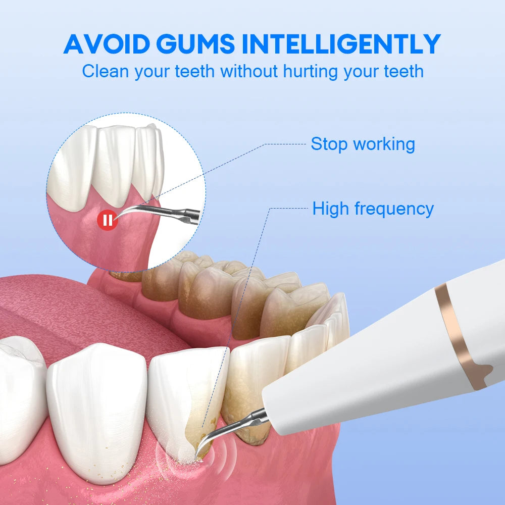 Ultrasonic Dental Calculus Remover Teeth Plaque Scaler Tartar Eliminator Stains Cleaner Electric Dental Tooth Stone Remover